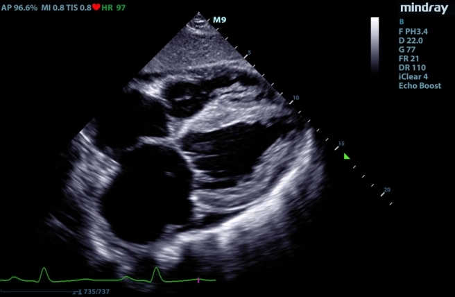 Echo serca psa, echo serca zwierząt