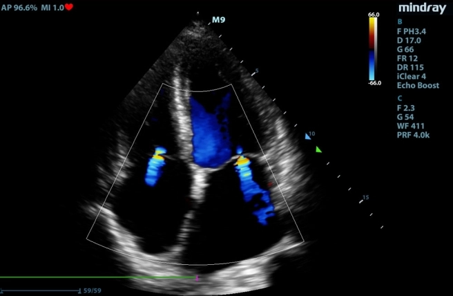 Badanie kardiologiczne psa, konsultacja kardiologiczna