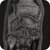 RM nadgarstka, łapy